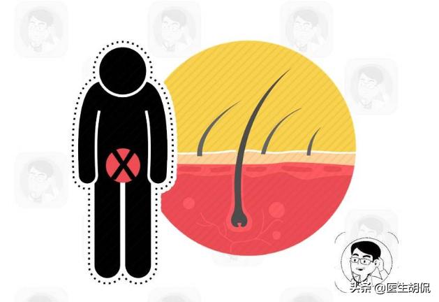 为什么有些女性“下面”会长“痘痘”？医生：或与3种疾病有关