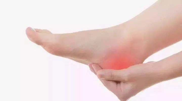 舒卿针灸教学足跟痛,足跟痛针灸的位置图