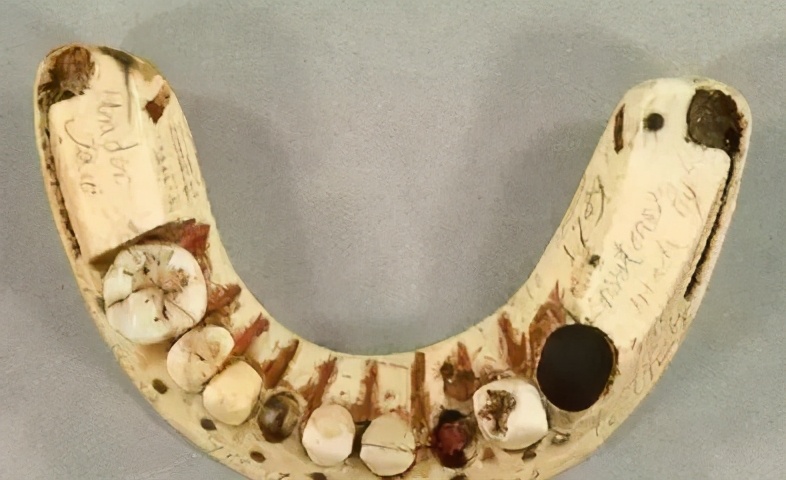 盘点下古今中外惨遭牙疼折磨的四位人物,最后一位太悲惨