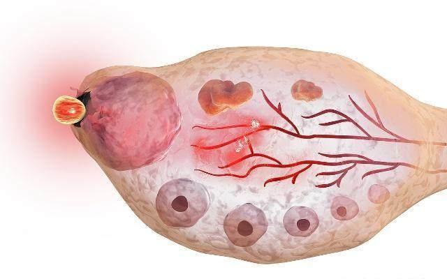 备孕期间正在排卵的征兆,排卵期是备孕的最佳时期