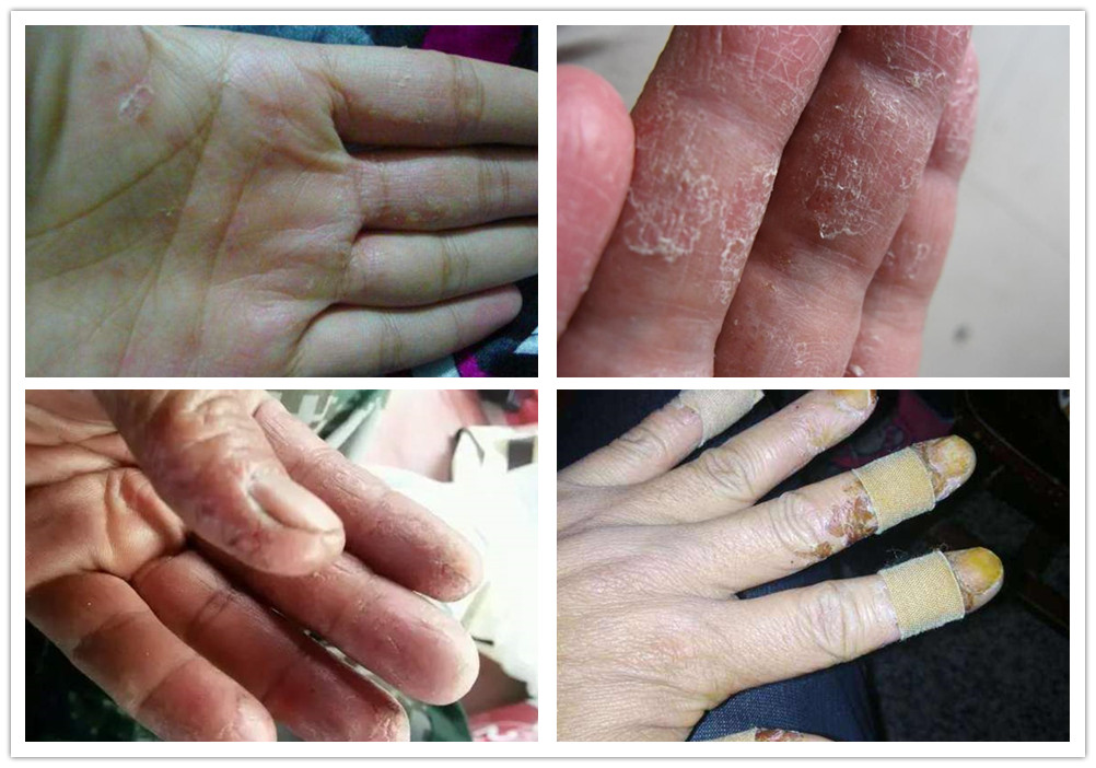 钓友注意这三种情况下最易断竿,劣质钓鱼饵料碰水就散