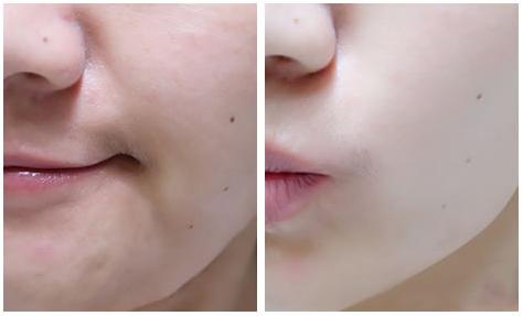 虾青素真的可以抗氧化吗,虾青素抗氧成功