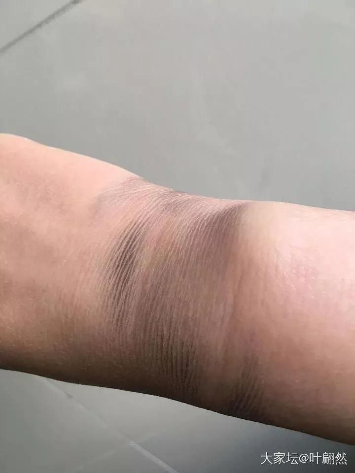 戴金镯手腕发黑,戴银手镯手腕一圈总是发黑为什么