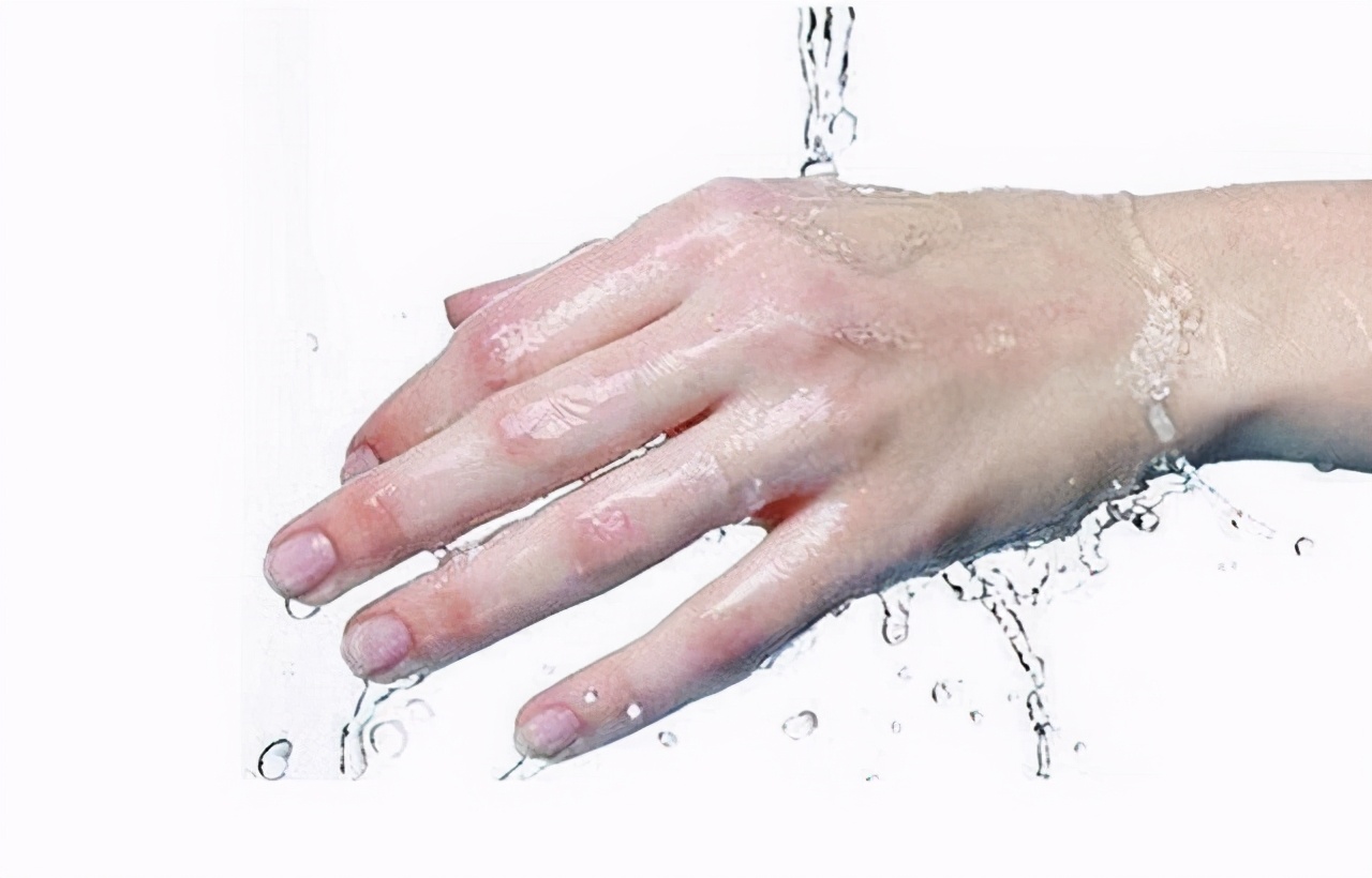 焊工触电急救的步骤和方法,焊工怎样不烫伤皮肤