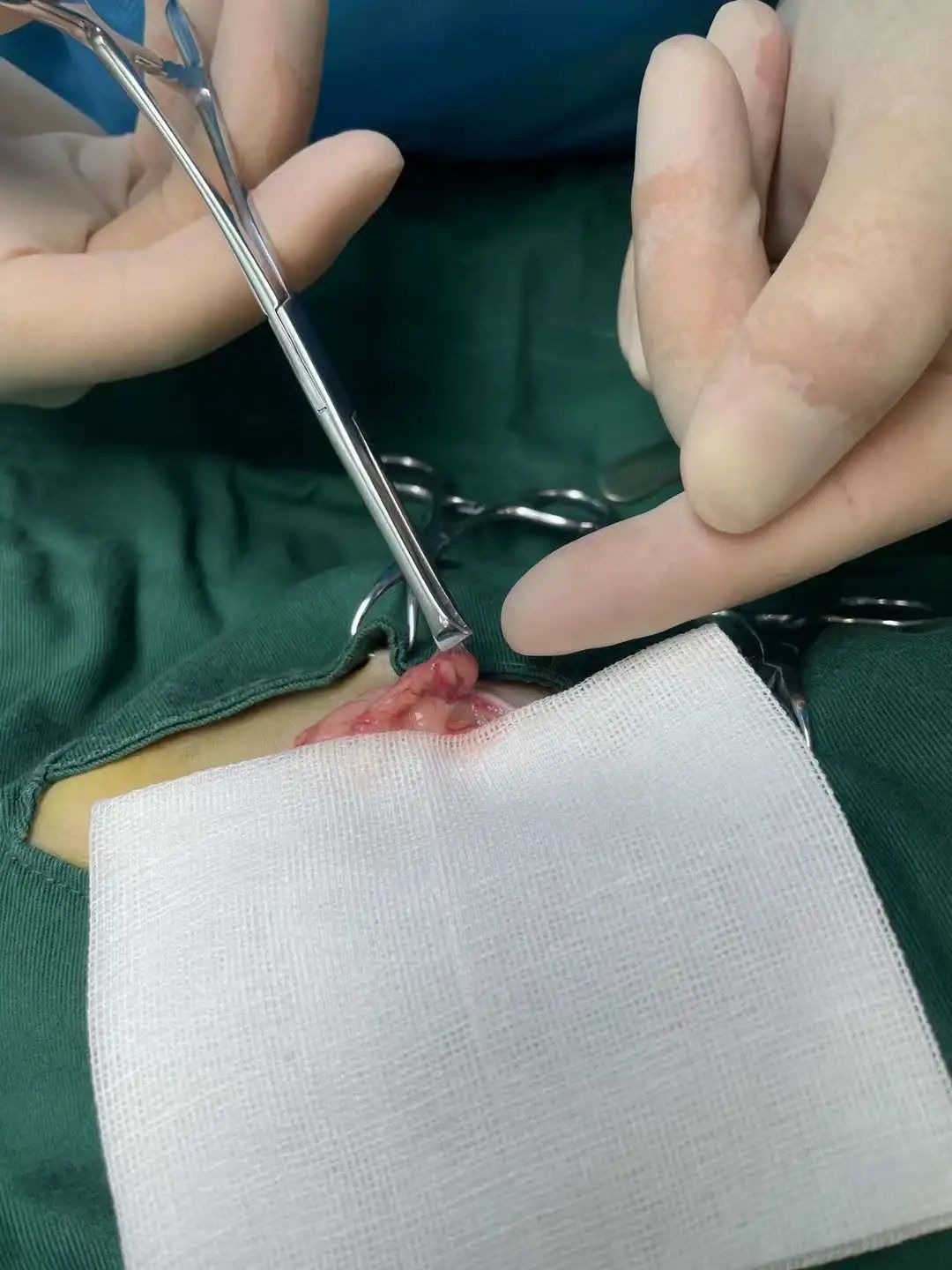 猫咪为什么绝育后还会叫,泰迪公犬做完绝育手术后还发情吗