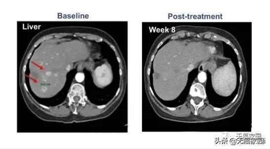 吴孟达肝癌去世的背后,赵英俊吴孟达肝癌