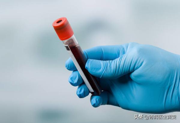 女性肾细胞癌能治好吗,肿瘤压迫肾脏会肾衰吗