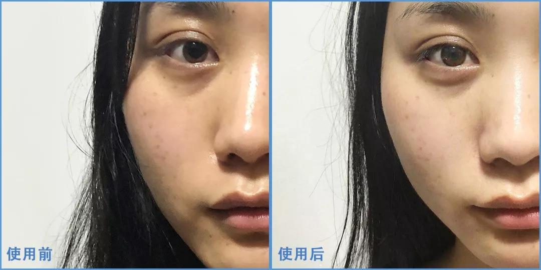 美白精华推荐14款,10款美白精华推荐