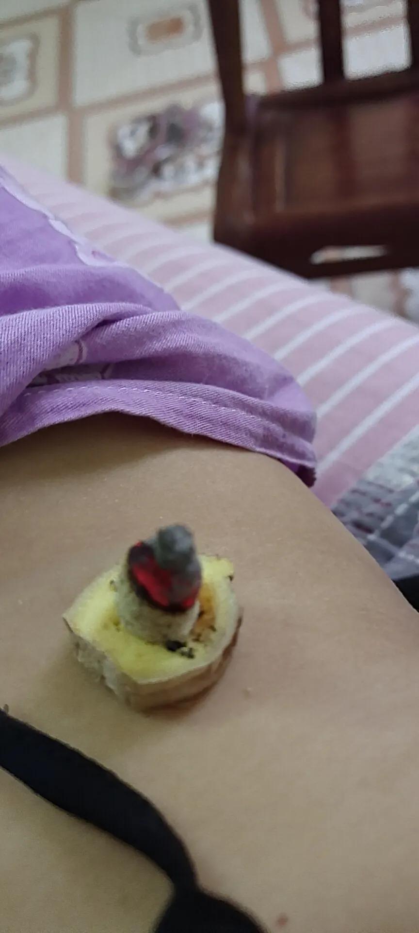 黄贵生针灸传承人,中医传承黄贵生视频