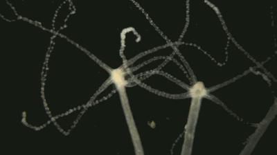 还想再活五百年？不，你的基因不想你活得那么久