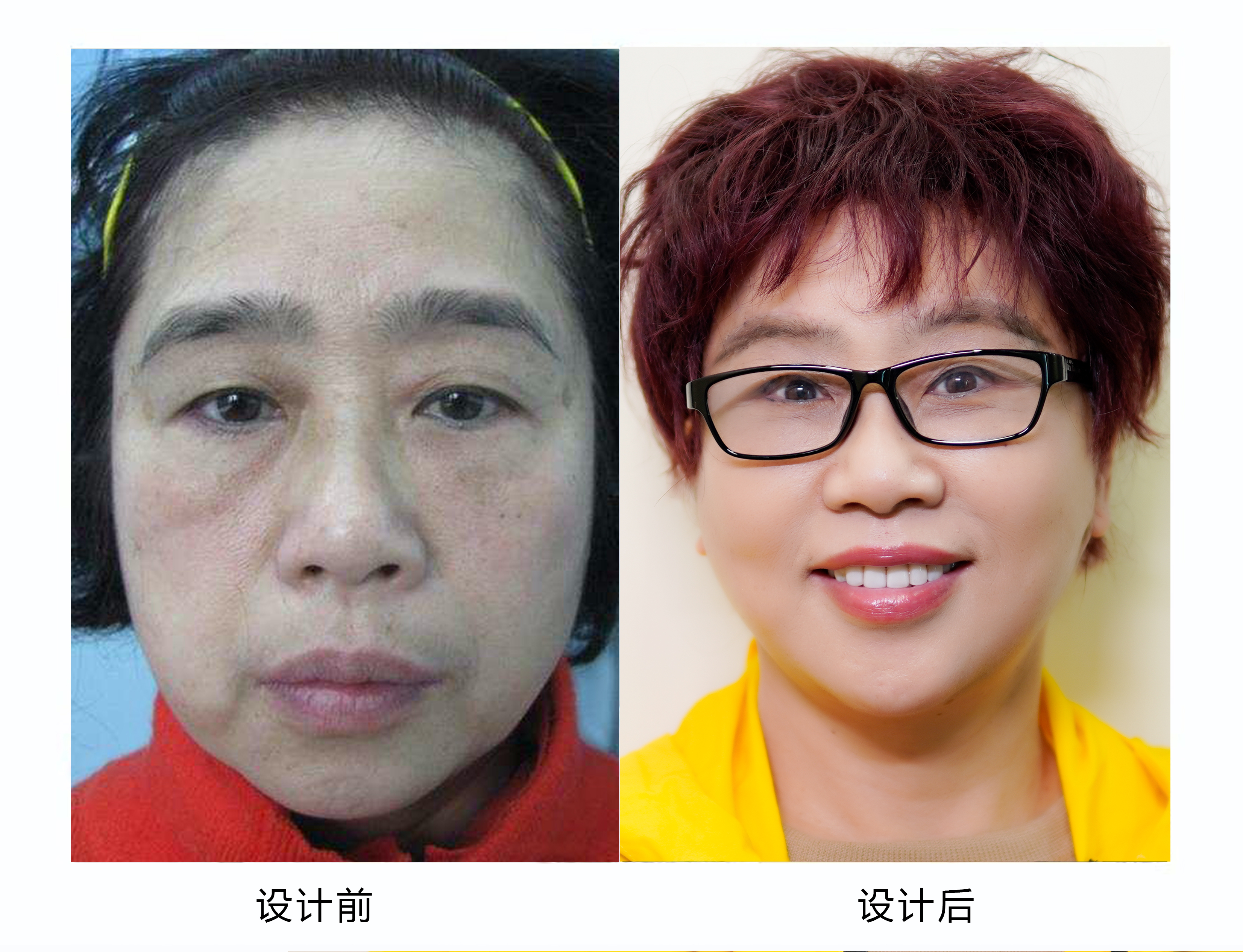 整形医生会给自己设计整形方案吗,整形医生也会整形吗