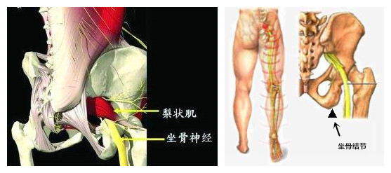 臀部感觉有根筋痛,臀部有一个点酸疼怎么回事