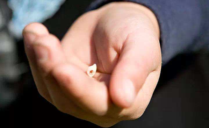 关于拔牙后的注意事项正确说法,70岁老人拔牙注意事项与禁忌症