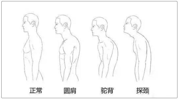 脖子后边的富贵包该怎么治疗,脖子后面的富贵包咋治呢