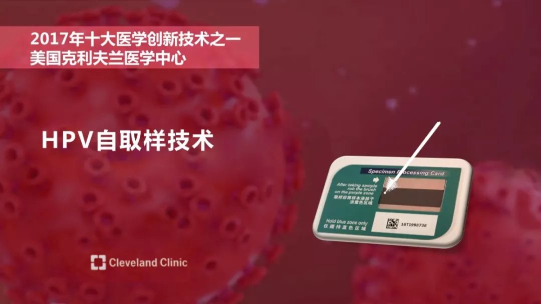 宫颈癌最深度解读,宫颈癌筛查报告正确解读