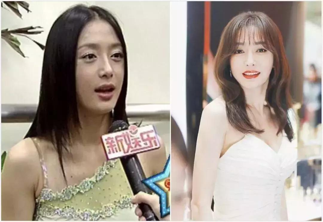 日本的美白针,日本最强美白针