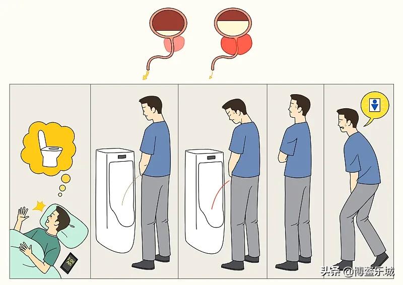 热疗消融治疗前列腺增生的优缺点,前列腺增生热疗消融手术靠谱吗