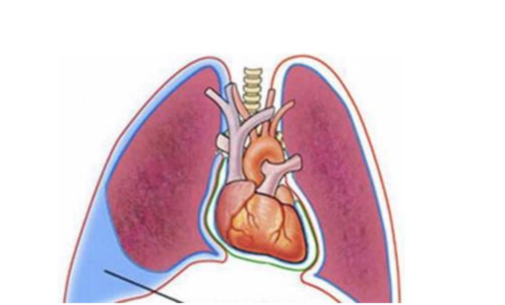 先心病术后注意事项,先心病后期注意事项