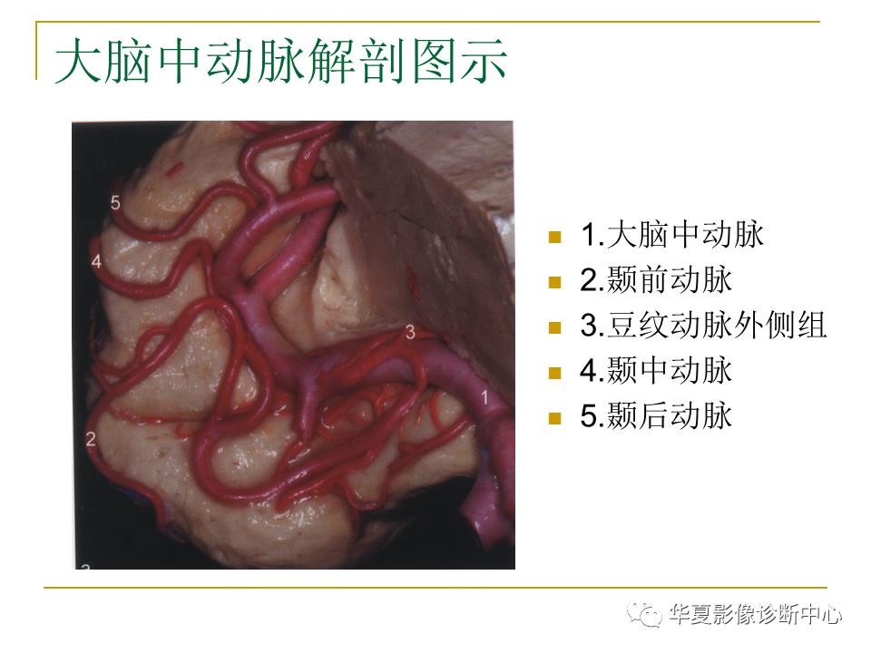 中国人脑立体定向mri应用解剖图谱,脑mri示意图