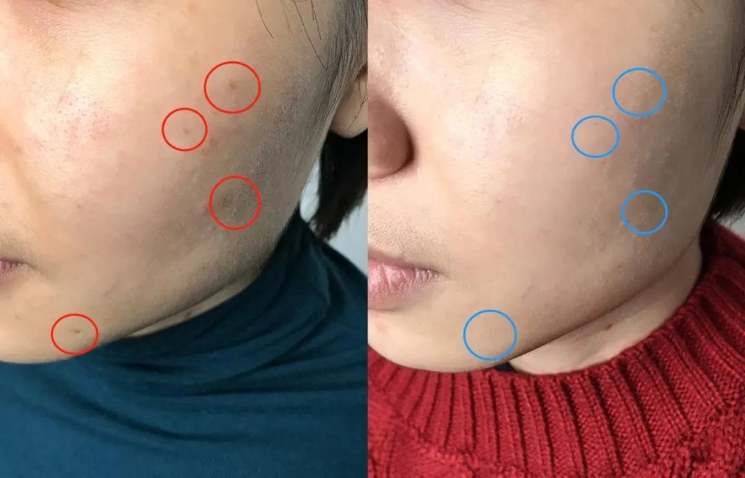 防晒和隔离是不是使人皮肤白,哪款隔离好用不暗沉