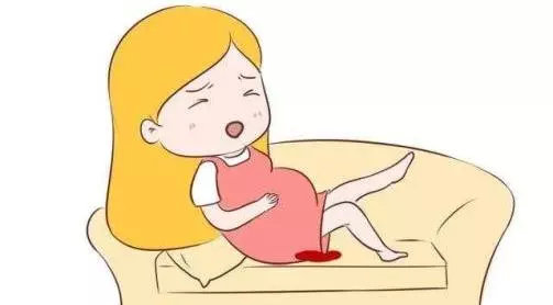 孕早期出血是流产吗？胎儿还能保住吗？