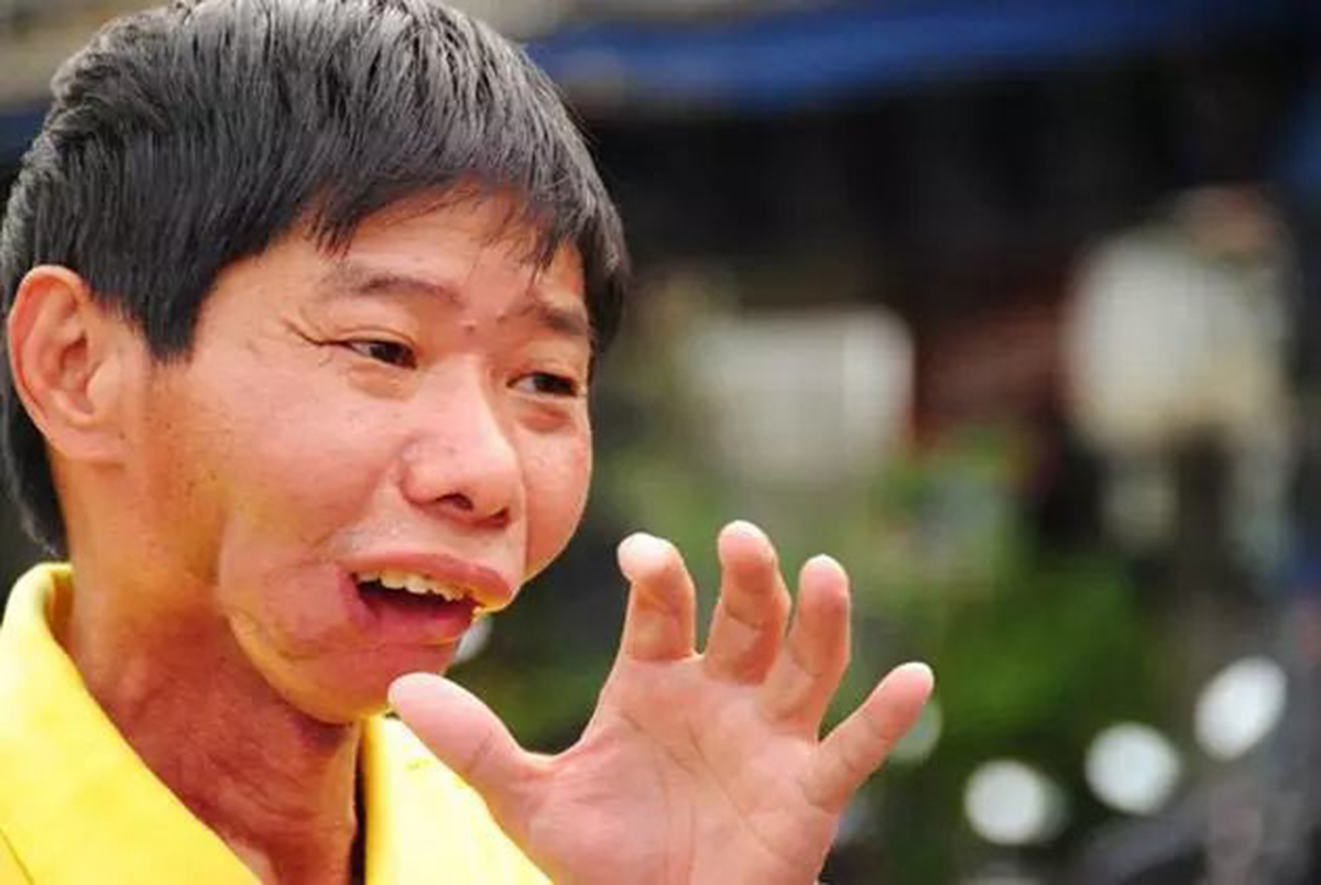 纪录片槟榔之殇,纪实记录槟榔之殇