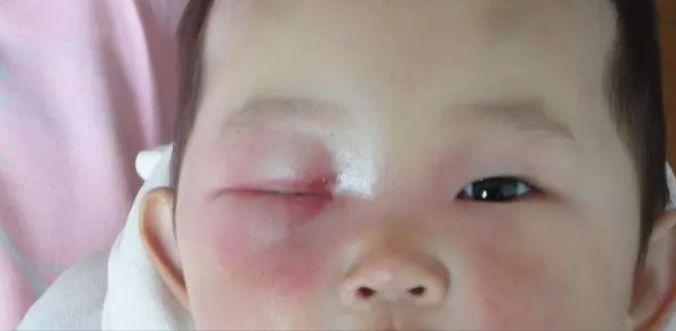 孕妇可以玩手机辐射对胎儿影响吗,手机对幼儿的辐射有多大的危害