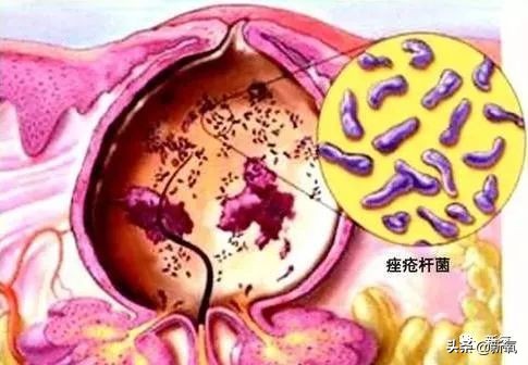 菜市场照猪肉的灯能美白吗,菜市场照肉的灯