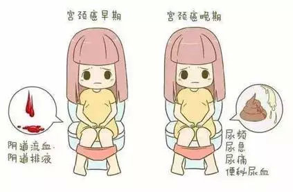 全国肿瘤防治宣传周向女性朋友们的忠告——如何预防妇科肿瘤