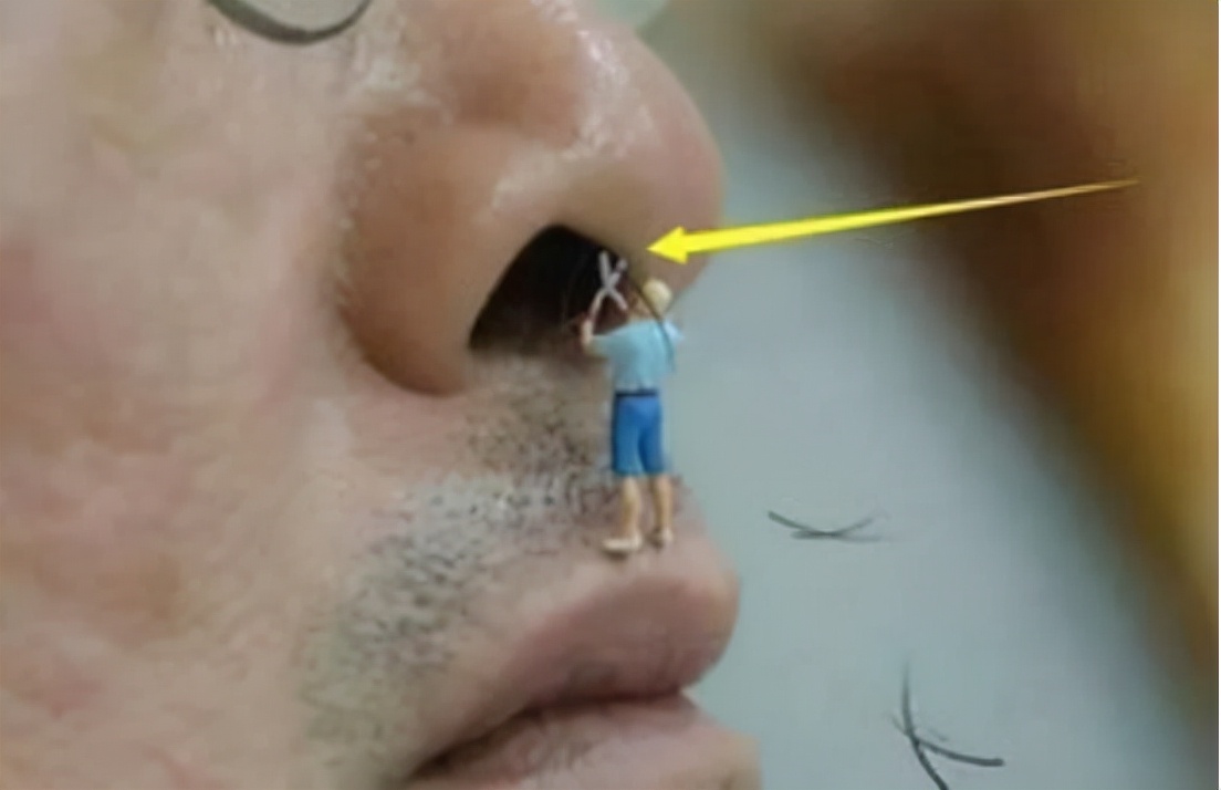 42岁鼻毛变白一定是衰老吗,鼻毛变白是衰老的前兆吗