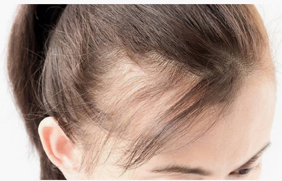 毛囊退化的原因和治疗方法,毛囊萎缩还能长出头发吗