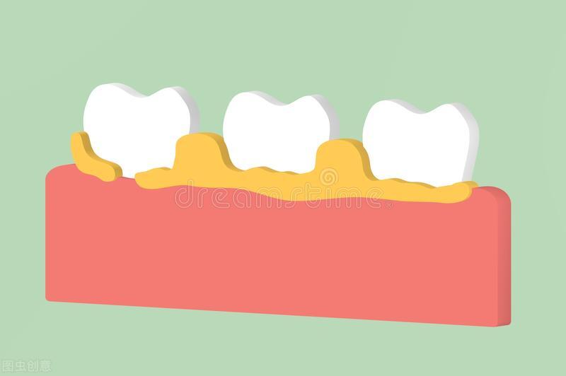 系统性红斑狼疮肠道病变,系统性红斑狼疮的胃肠道系统表现