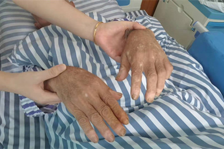 为什么会患类风湿，这些发作诱因你中招了吗？