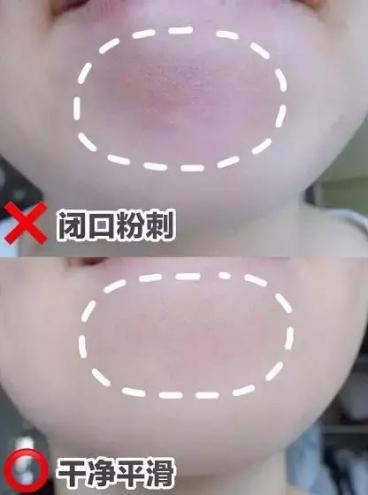 喷雾式的去黑头的东西,去黑头收缩毛孔吸黑头神器测评