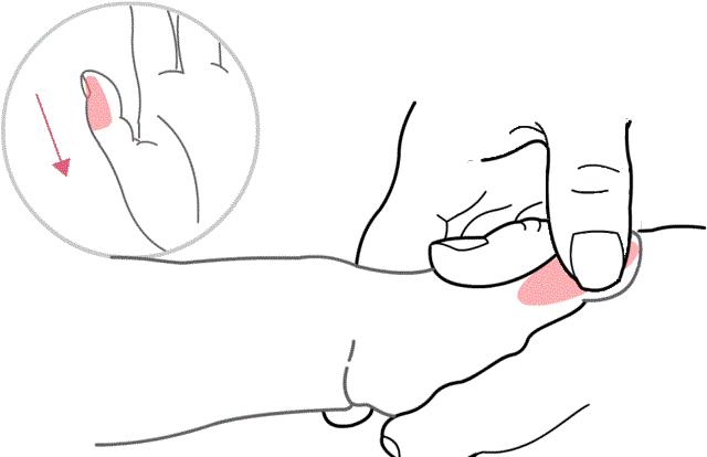 宝宝湿疹怎么推拿处理,小儿推拿治疗湿疹