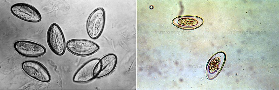 现在小学生要打虫吗,孩子打虫的季节