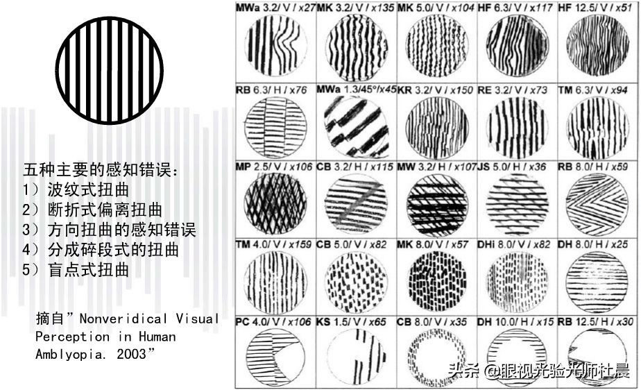 弱视训练提升视力,弱视训练是根据视力训练的吗
