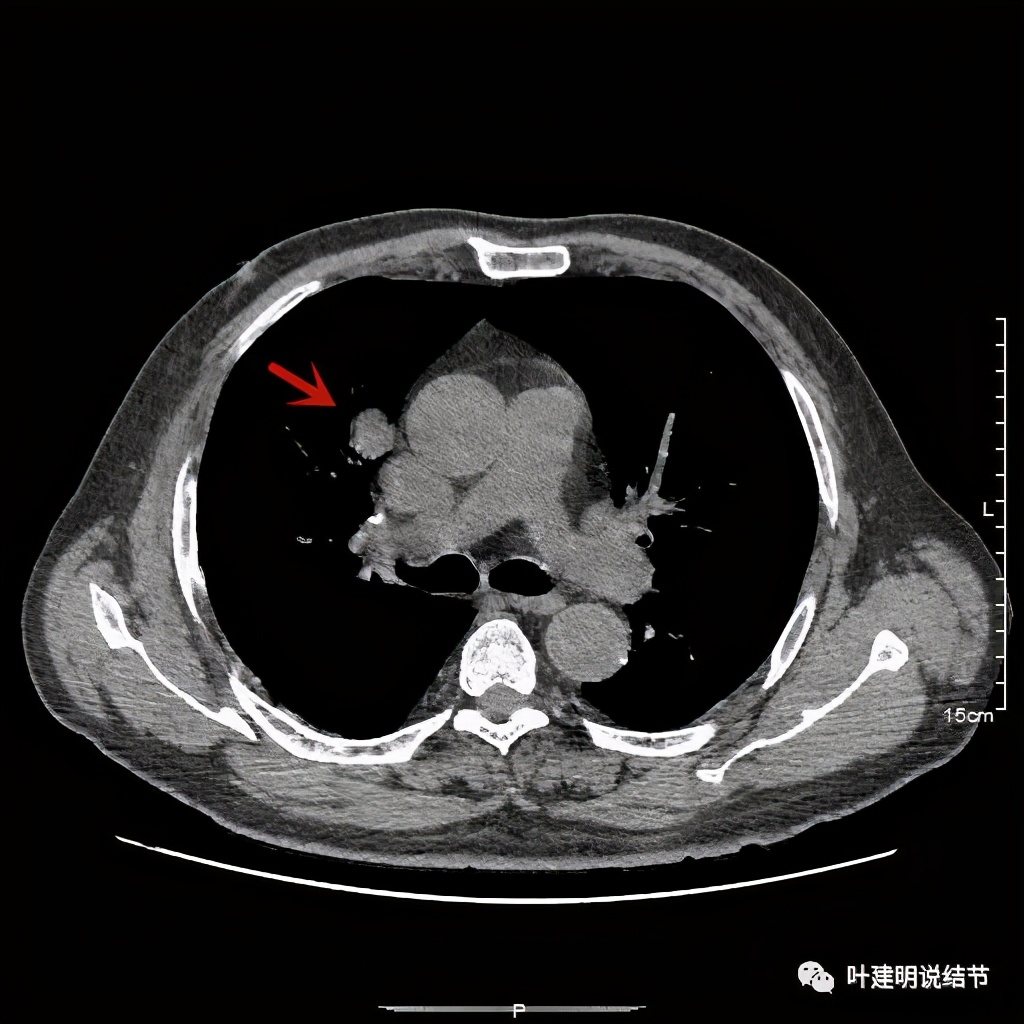 误诊报告图片,误诊案例及案例分析