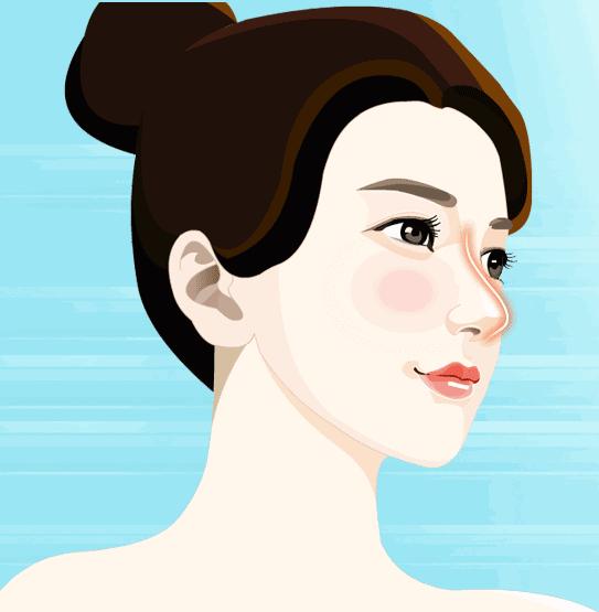 隆鼻膨体好还是玻尿酸好,硅胶膨体和玻尿酸隆鼻