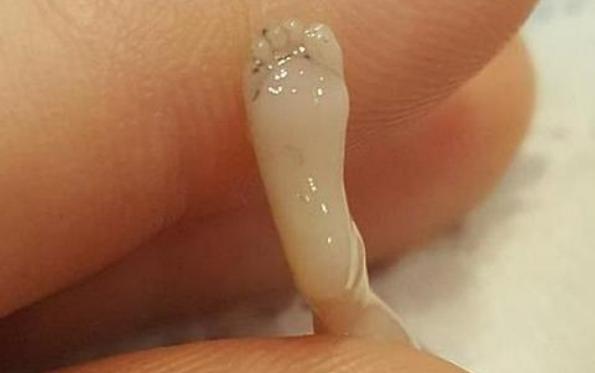 人工流产的胎儿最后去哪了,人工流产胎儿去哪了