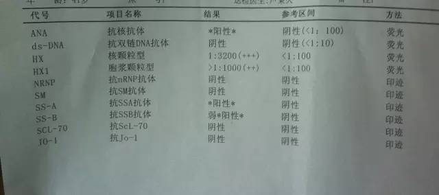 干燥综合征最佳化验指标,干燥综合征确诊的指标