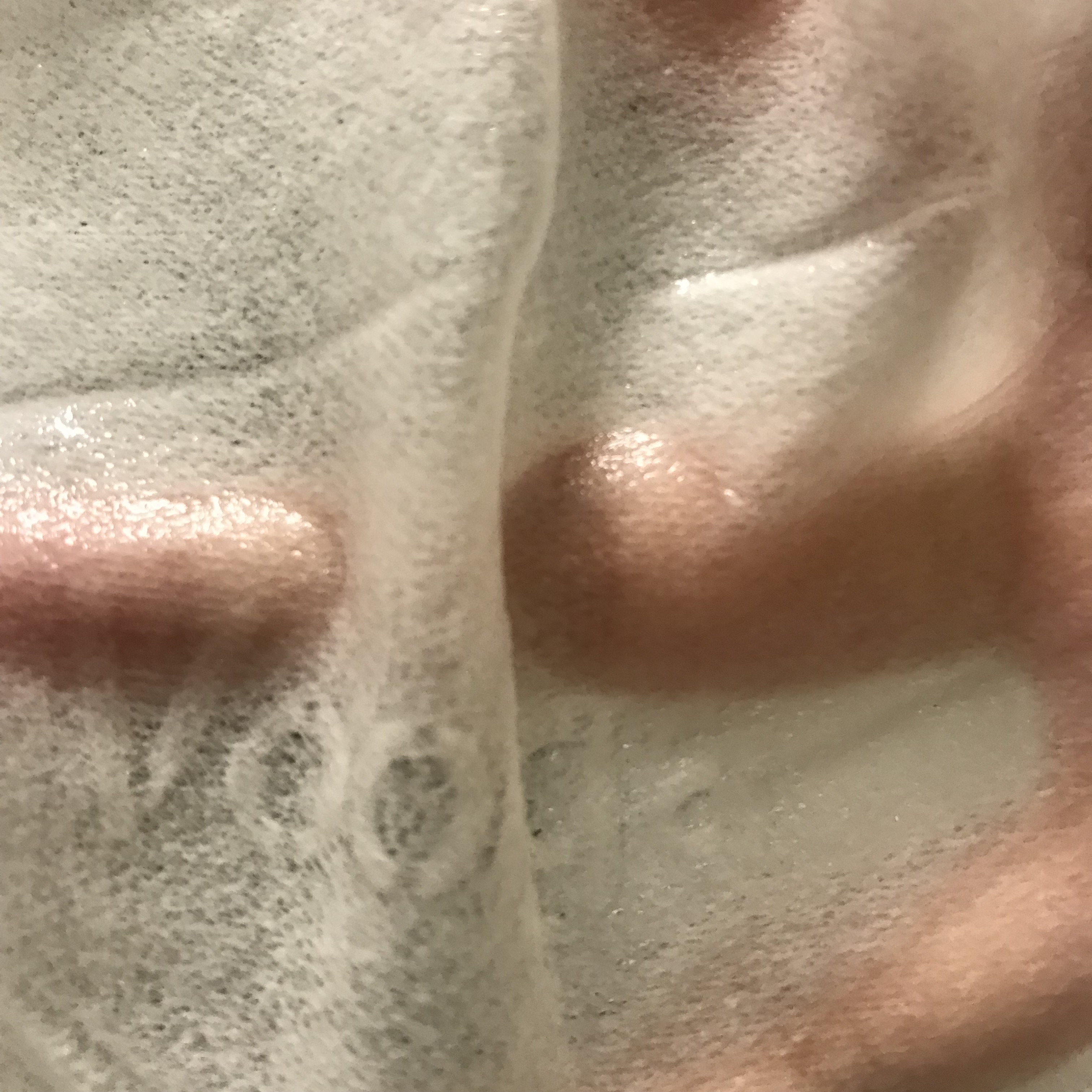 敏感肌*血丝红**终于有救了!敷尔佳新款绿膜,医美面膜王者不服不行