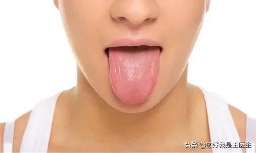 舌苔黄腻用生薏苡仁还是炒薏苡仁,舌苔厚腻祛湿没有效果