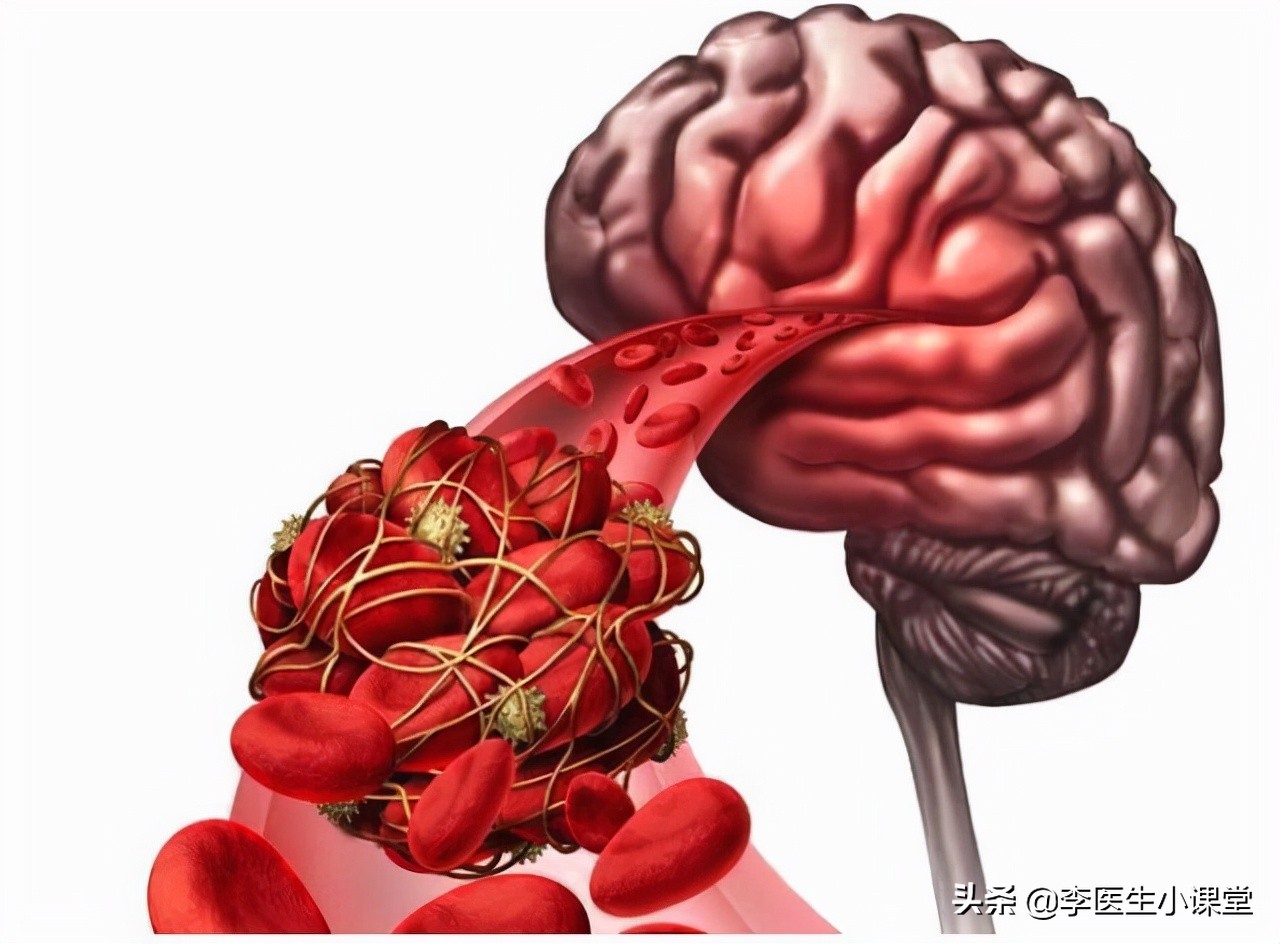 治疗脑供血不足的药物有哪些,脑供血不足头晕能服用哪些药物