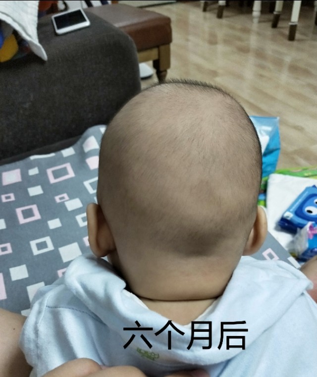 偏头的宝宝要如何调整过来,纠正宝宝偏头的小妙招