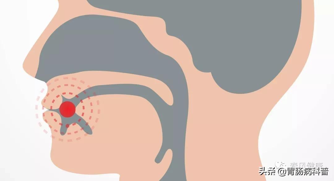 癌前病变虽不是癌症，但这8种情况一定别轻视