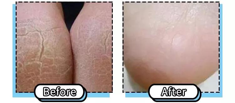 9.9元绵羊油保湿霜,绵羊油8.8元三盒