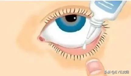 怎样才是滴眼药水正确方法,眼药水的顺序用错了如何补救