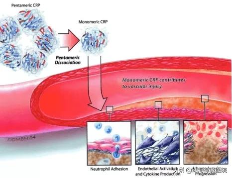 crp是什么材料,crp检测是什么意思啊
