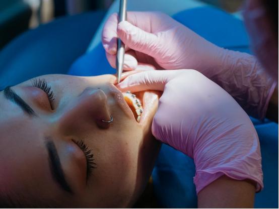 戴牙套脸凹陷能恢复吗,大龄整牙以后牙套脸什么时候恢复